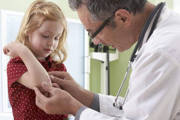 doctor examinando a un niño con psoriasis