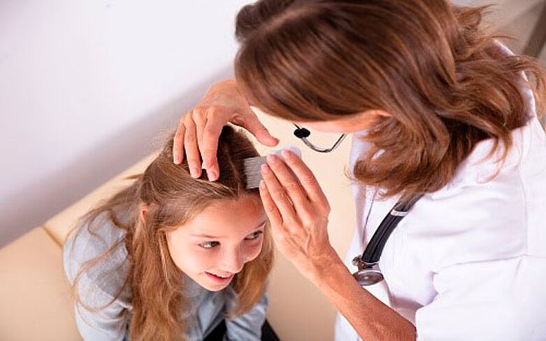 tratamiento de la psoriasis de la cabeza en niños