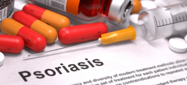 medicamentos para la psoriasis