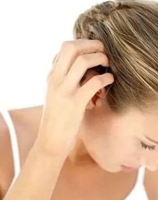 Tratamiento de la psoriasis