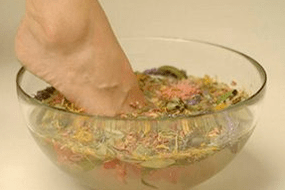 Baños para el tratamiento de la psoriasis.